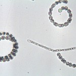 Exemple d’espèces de cyanobactéries déterminées lors d’une analyse de phytoplancton